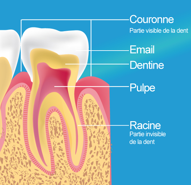 Traitement endodontique Vincennes
